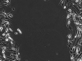 Fibroblast scratch-wound assay timelapse